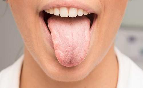 علت بوی بد دهان چیست؟ راه درمان با تغییر چند عادت روزانه