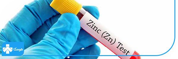 شرایط انجام آزمایش Zinc چیست