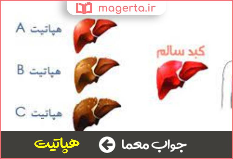 جواب معما نوعی بیماری التهابی در جدول