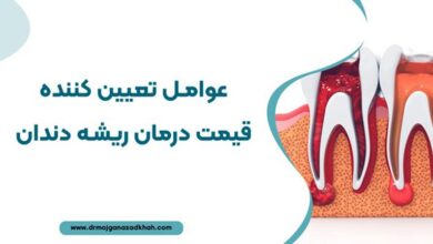 عوامل تعیین کننده قیمت درمان ریشه دندان