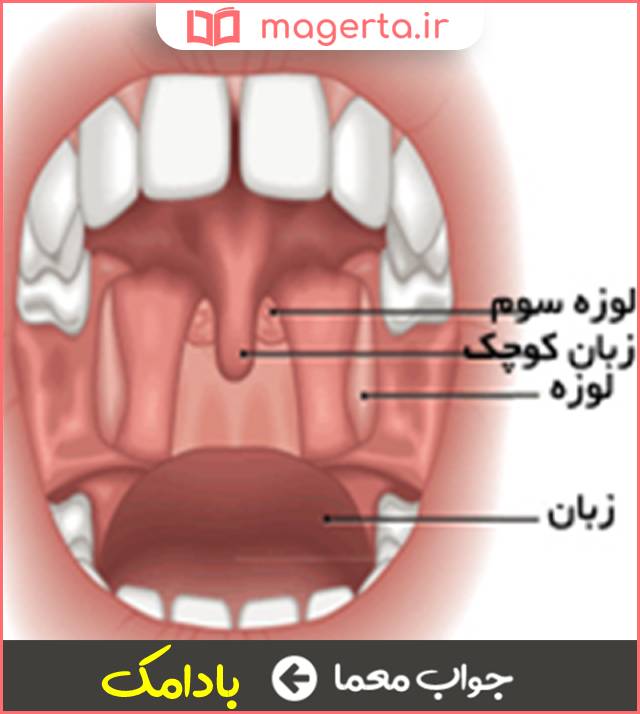 جواب معما لوزه سوم انسان در جدول