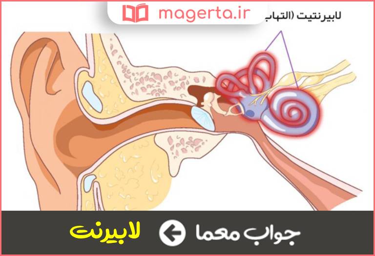 جواب معما بخش حلزونی گوش میانی در جدول