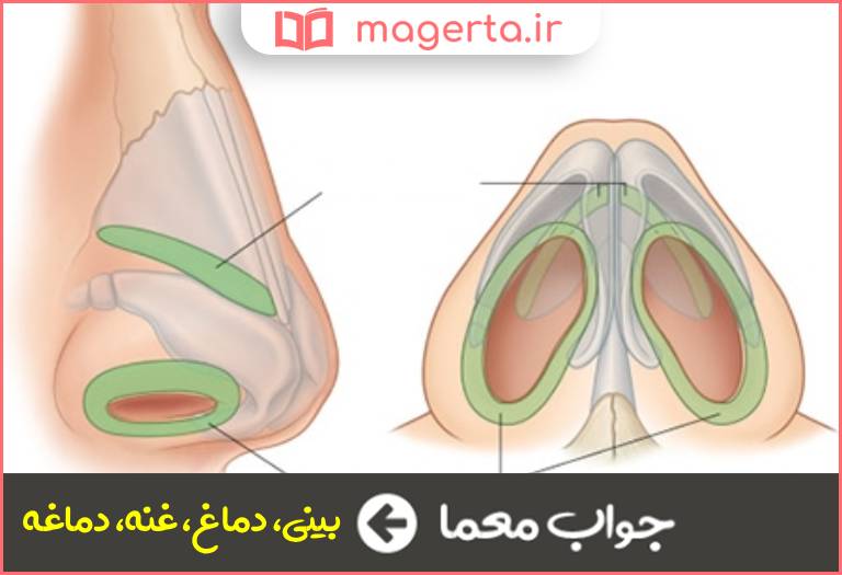 جواب معما قسمت درونی بینی در جدول