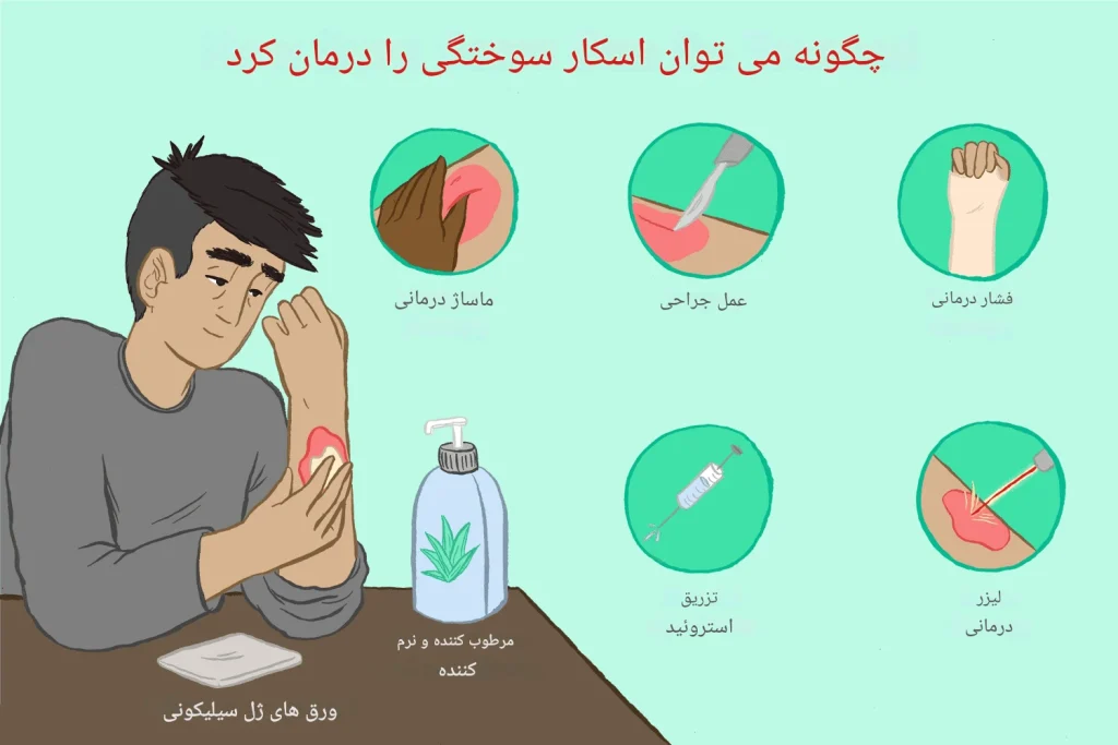 راه‌های درمان جای زخم سوختگی