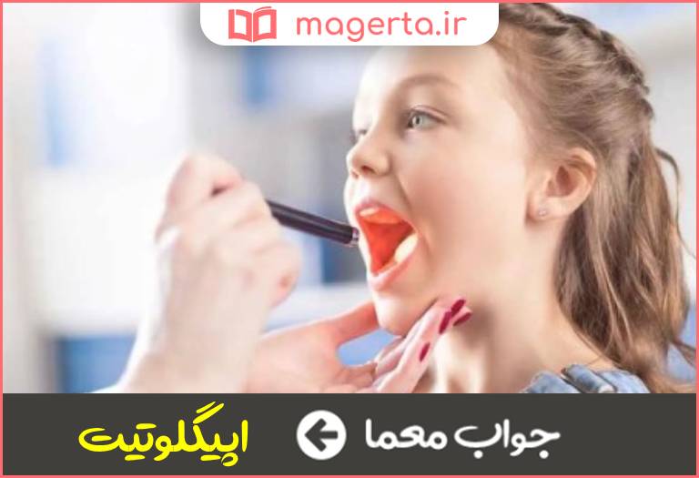 جواب معما از امراض کودکان در جدول