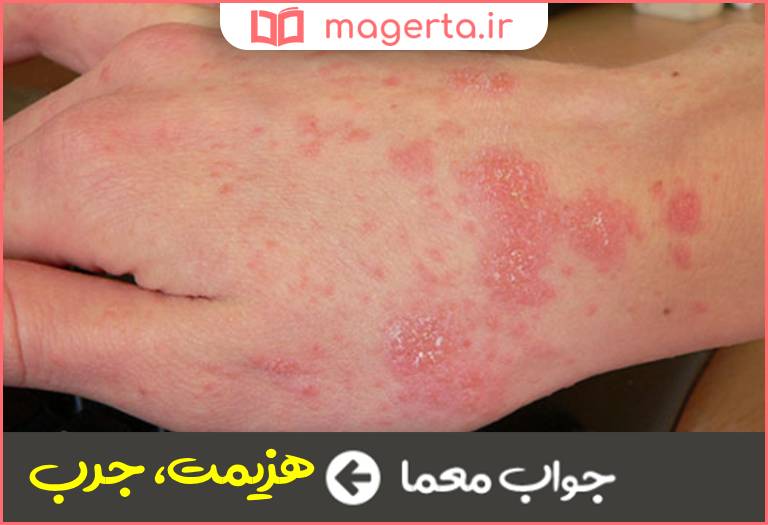 جواب معما گال در جدول