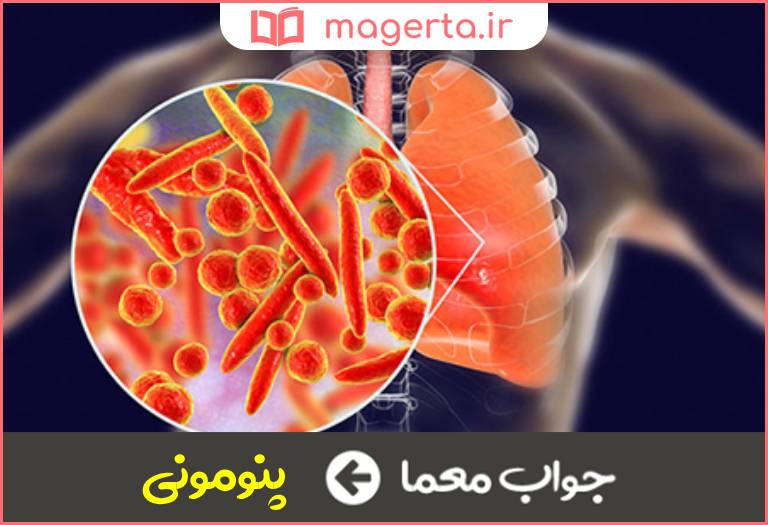 جواب معما نام علمی ذات الریه در جدول