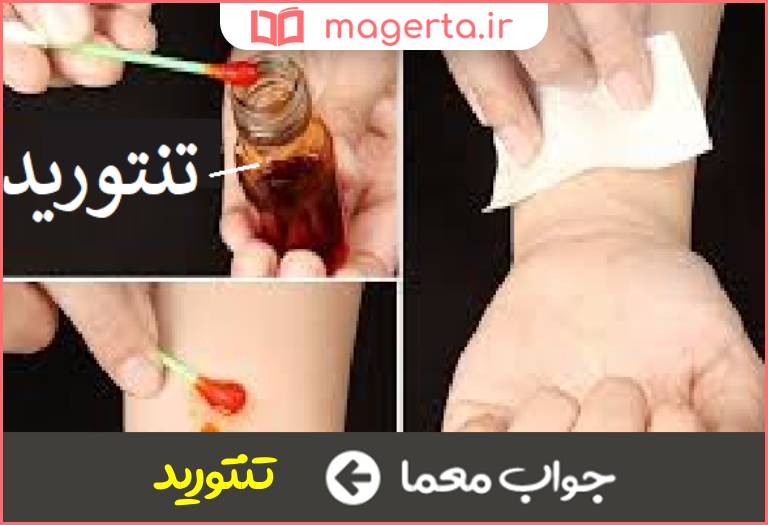 جواب معما محلولی برای ضد عفونی زخم در جدول