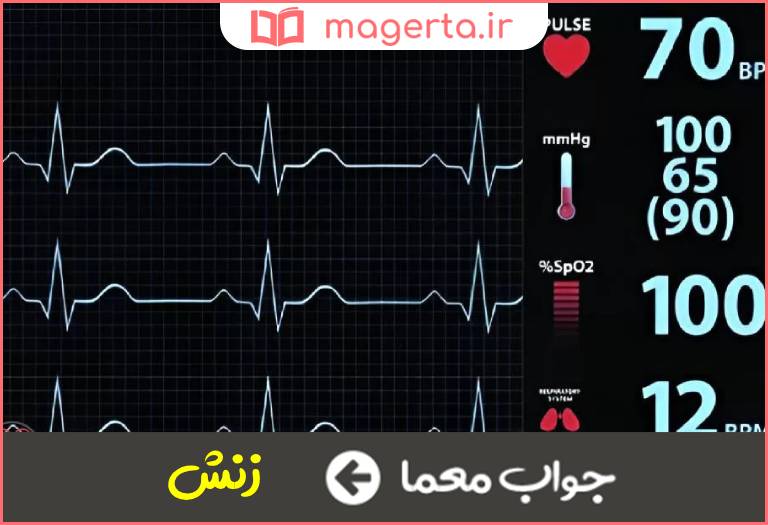 جواب معما ضربان داشتن در جدول