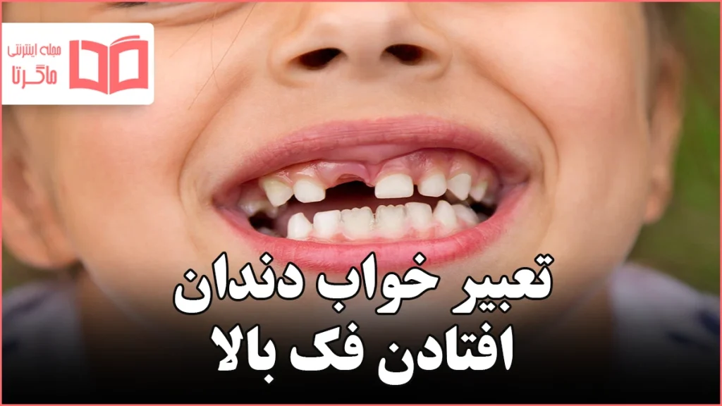 تعبیر خواب دندان افتادن فک بالا