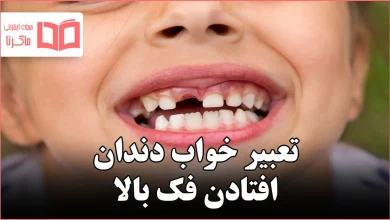 تعبیر خواب دندان افتادن فک بالا