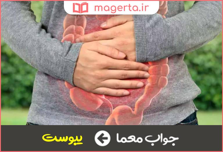 جواب معما بیماری خشکی در جدول