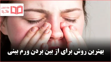 بهترین روش برای از بین بردن ورم بینی
