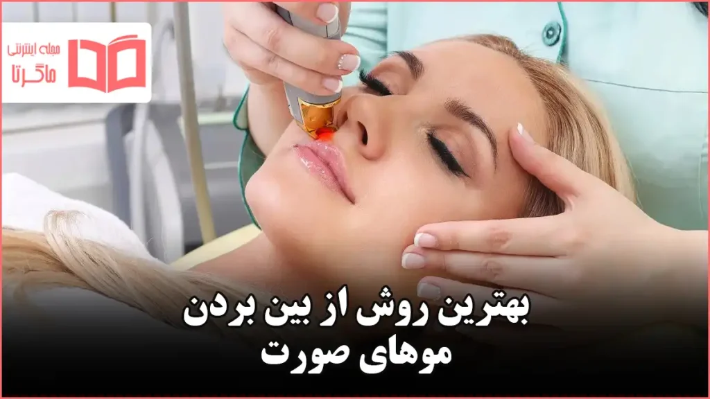 بهترین روش از بین بردن موهای صورت