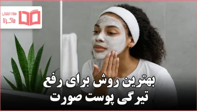 بهترین روش برای رفع تیرگی پوست صورت