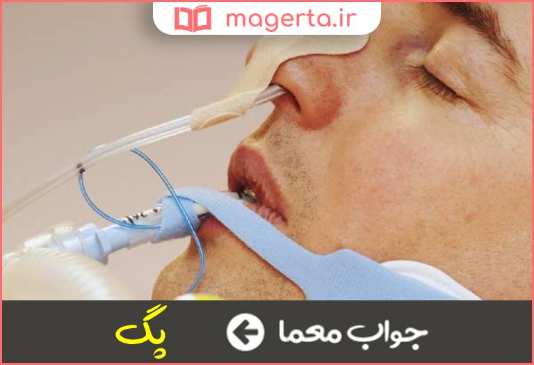 جواب معما روشی برای غذا دادن به بیمار در جدول