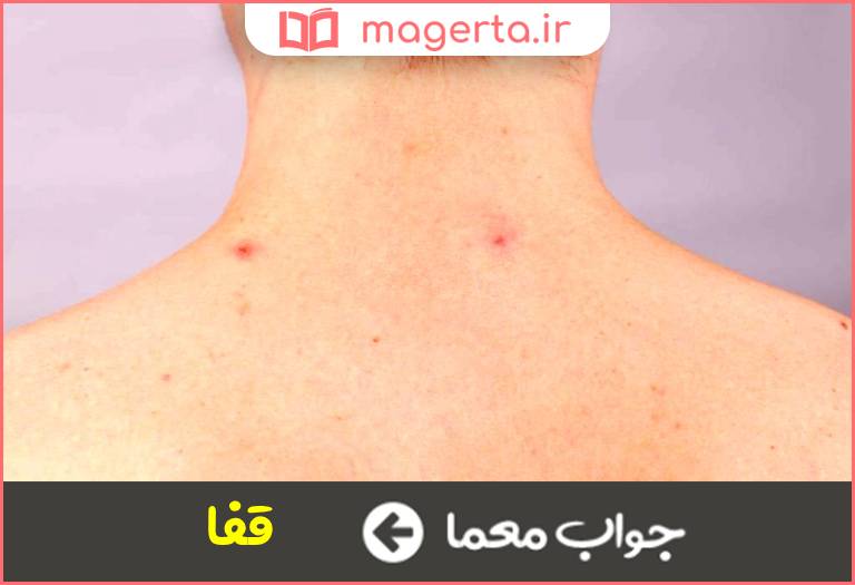 جواب معما پشت گردن در جدول