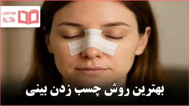 بهترین روش چسب زدن بینی