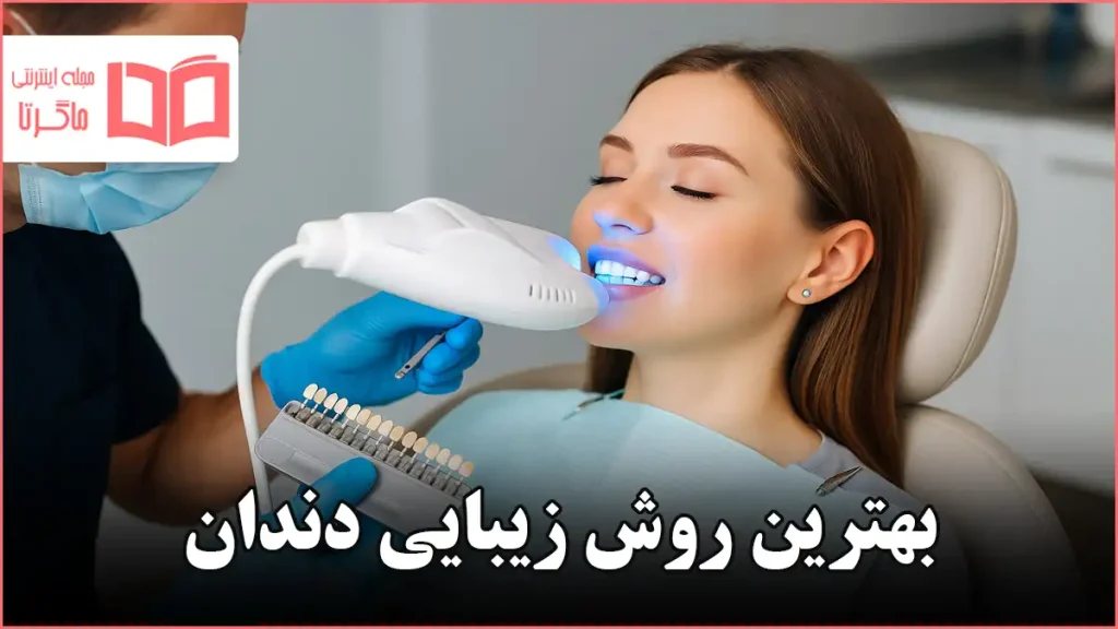 بهترین روش زیبایی دندان