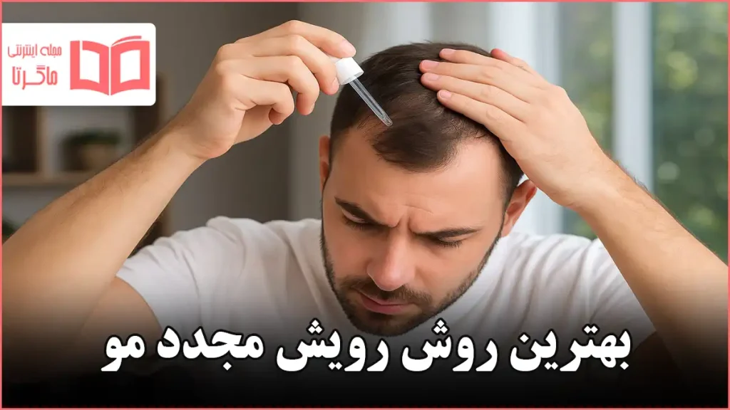 بهترین روش رویش مجدد مو