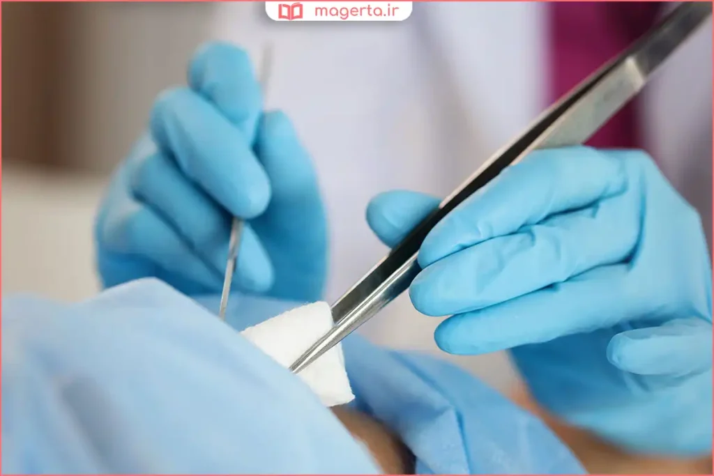 پزشک در حال آماده‌سازی نوزاد برای انجام ختنه در کلینیک