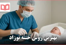 بهترین روش ختنه نوزاد