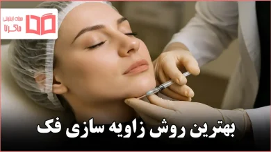بهترین روش زاویه سازی فک