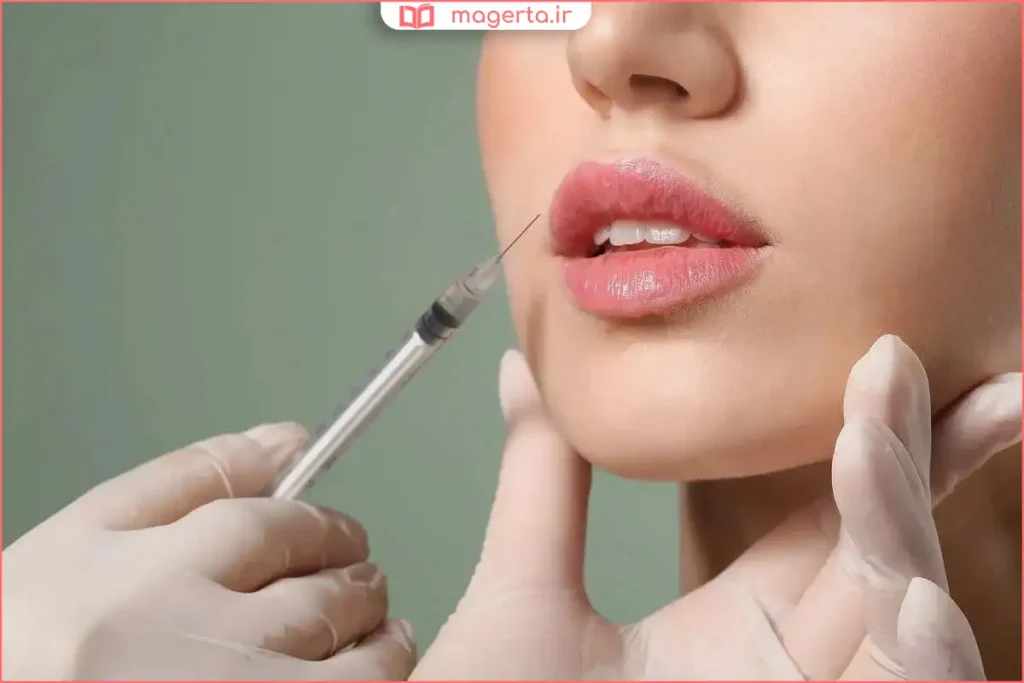 نمای نزدیک از مراحل تزریق ژل به لب بالا