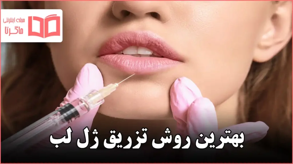بهترین روش تزریق ژل لب