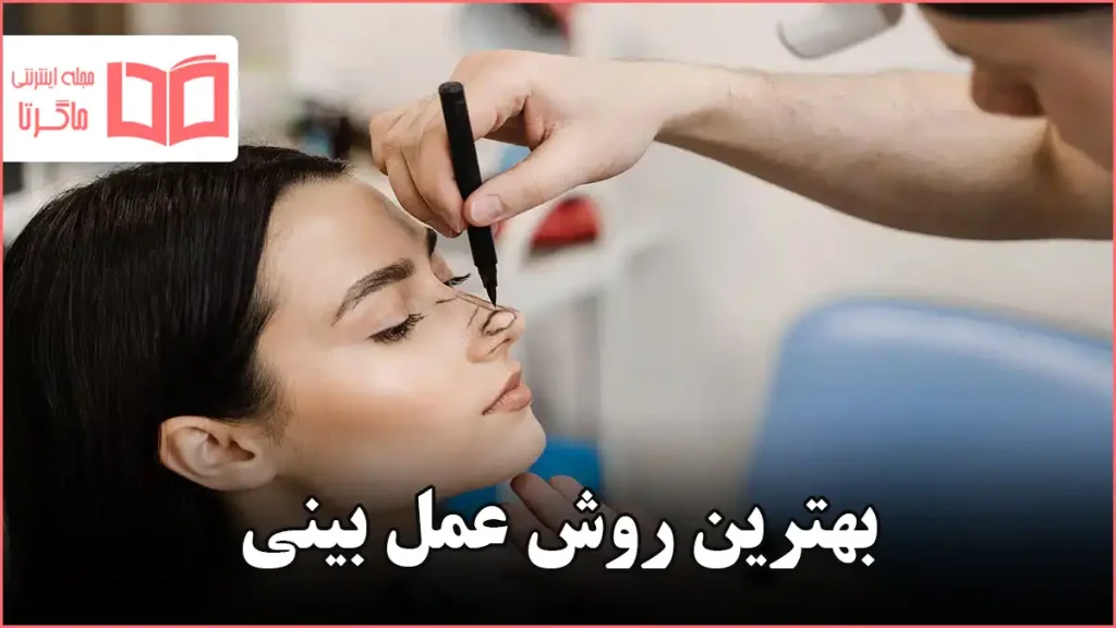 بهترین روش عمل بینی