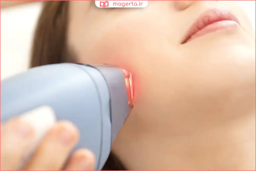 استفاده از دستگاه لیزر برای حذف موهای زائد بدن