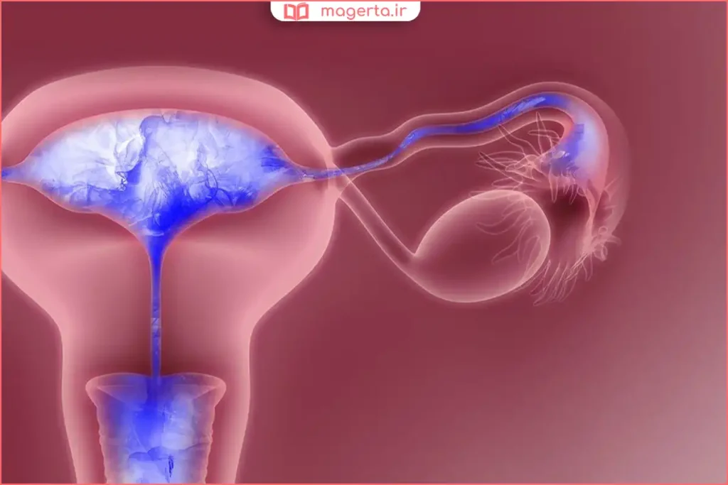 نمای گرافیکی از رحم و تخمدانها هنگام انجام عکس رنگی