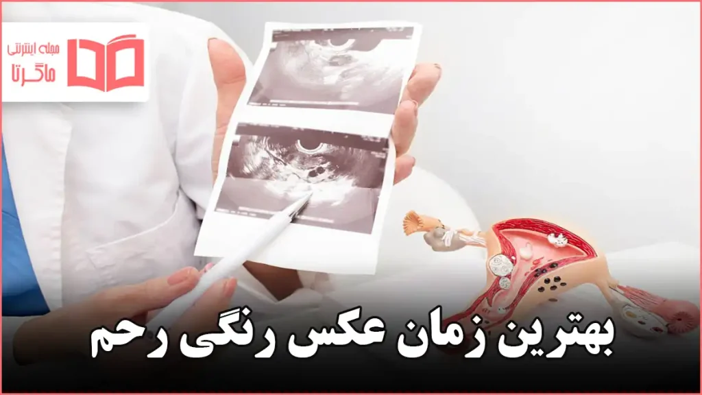 بهترین زمان عکس رنگی رحم