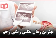 بهترین زمان عکس رنگی رحم