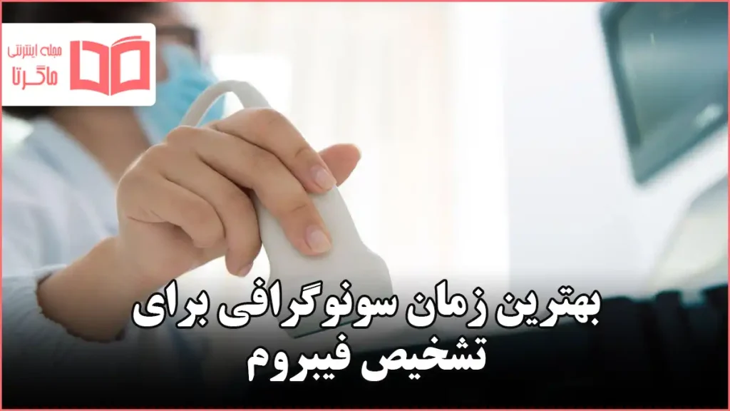 بهترین زمان سونوگرافی برای تشخیص فیبروم