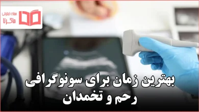 بهترین زمان برای سونوگرافی رحم و تخمدان