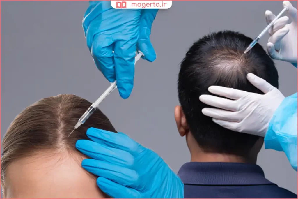 مراجعه به پزشک متخصص پوست و مو برای درمان ریزش