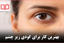 بهترین کار برای گودی زیر چشم