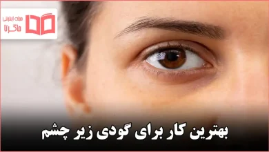 بهترین کار برای گودی زیر چشم