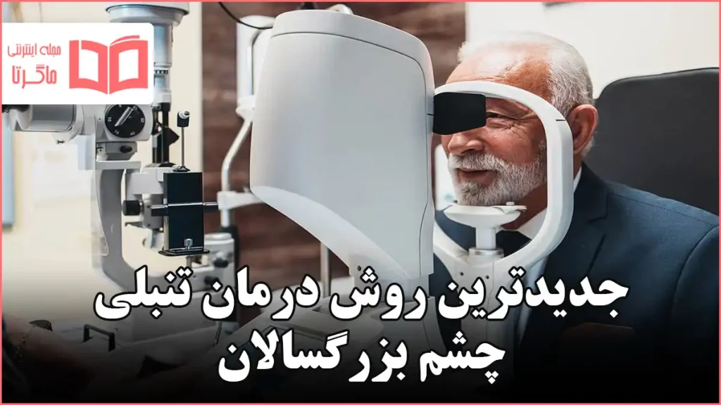 جدیدترین روش درمان تنبلی چشم بزرگسالان