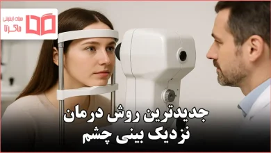 جدیدترین روش درمان نزدیک بینی چشم