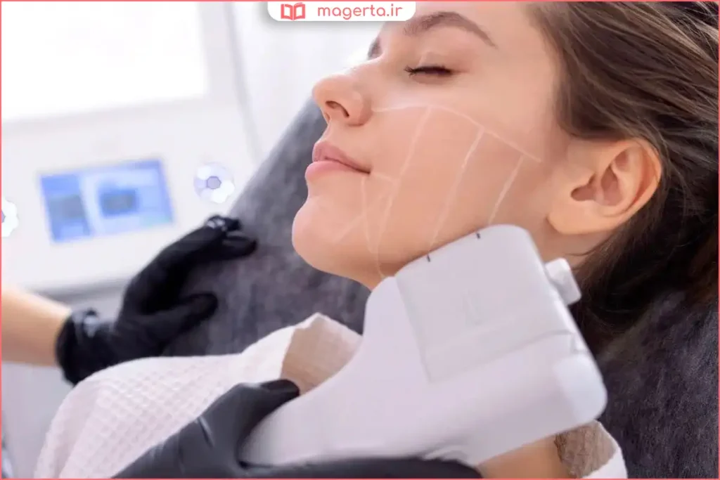 زن جوان در حال انجام لیفت صورت با دستگاه هایفوتراپی