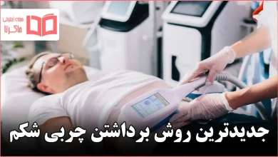 جدیدترین روش برداشتن چربی شکم