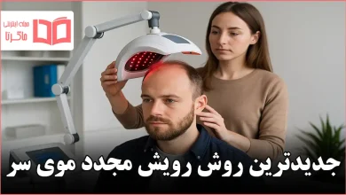 جدیدترین روش رویش مجدد موی سر