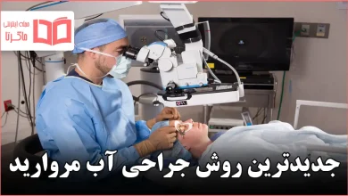جدیدترین روش جراحی آب مروارید