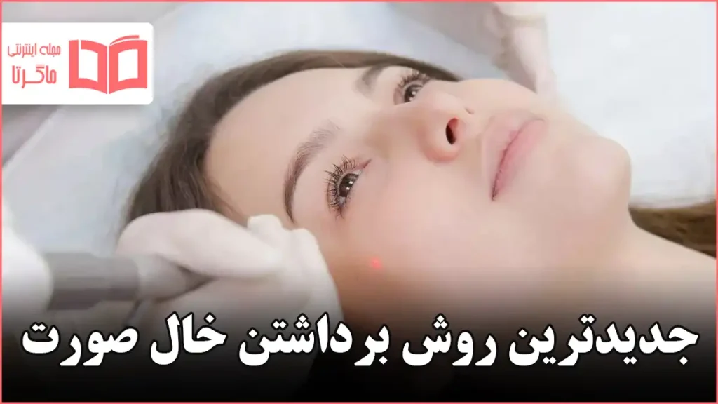 جدیدترین روش برداشتن خال صورت