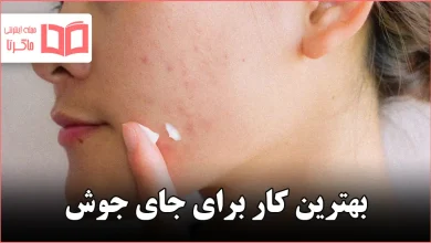 بهترین کار برای جای جوش