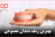 بهترین رنگ دندان مصنوعی