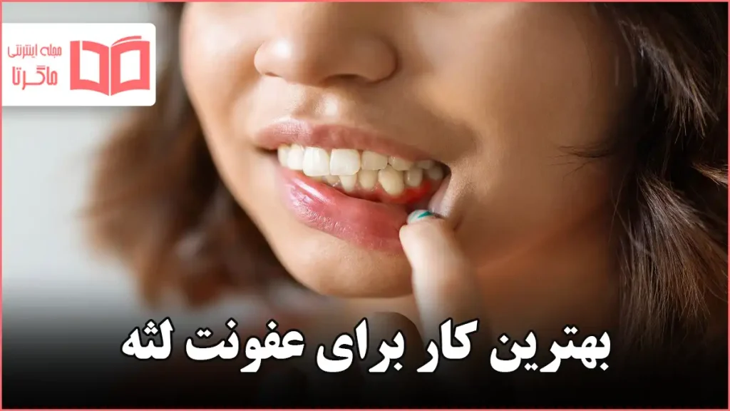 بهترین کار برای عفونت لثه