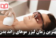 بهترین زمان لیزر موهای زائد بدن